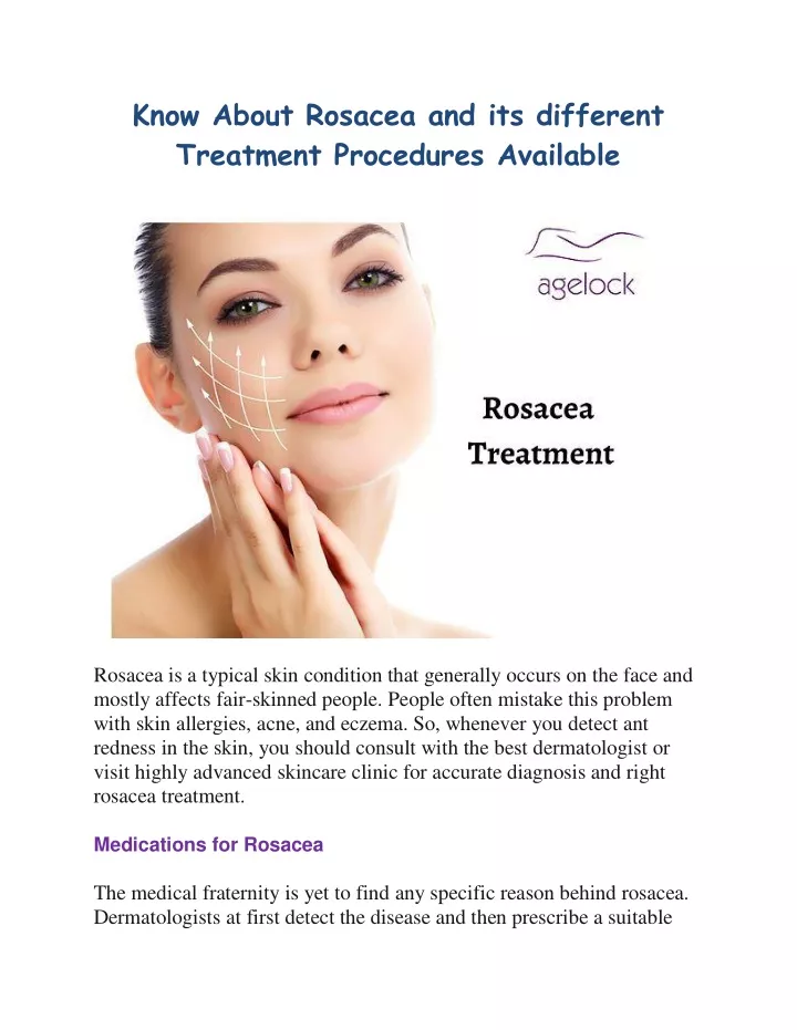 know about rosacea and its different treatment