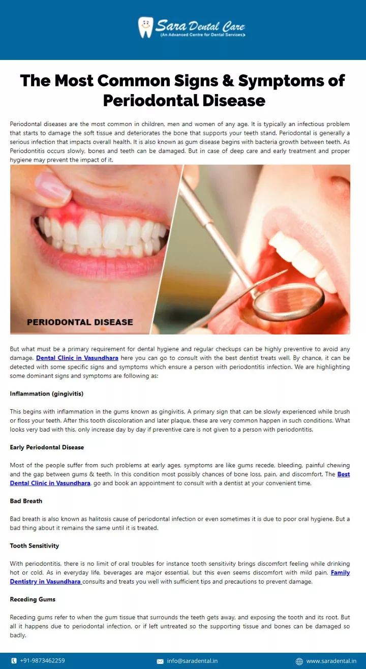 the most common signs symptoms of periodontal