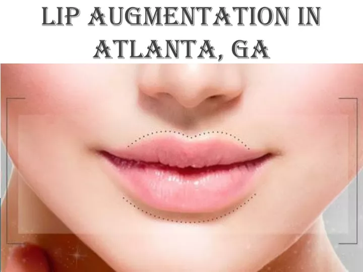 lip augmentation in atlanta ga