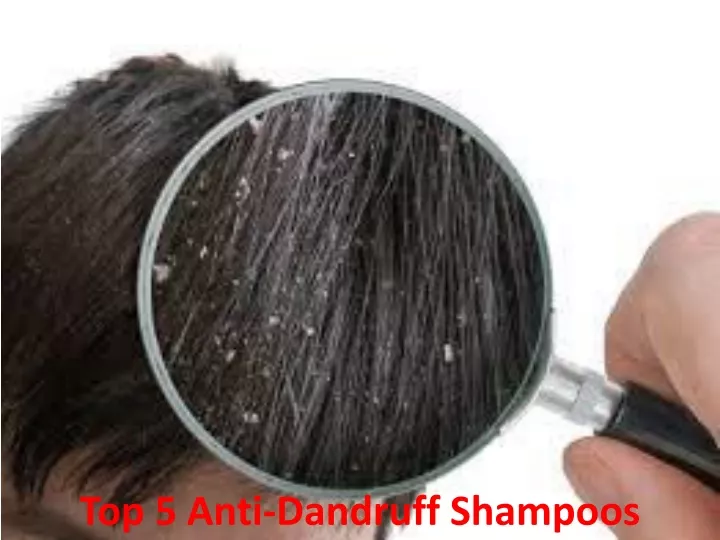 top 5 anti dandruff shampoos