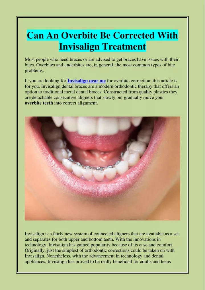 can an overbite be corrected with invisalign