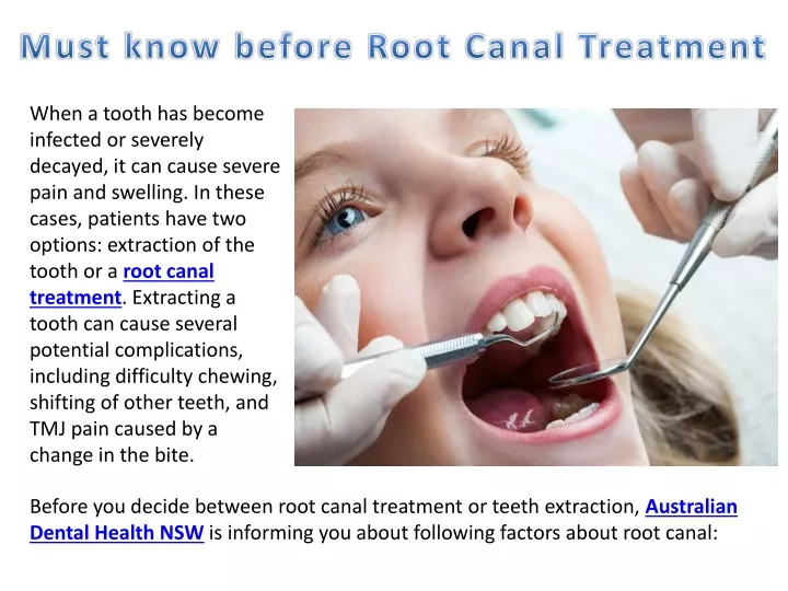 must know before root canal treatment