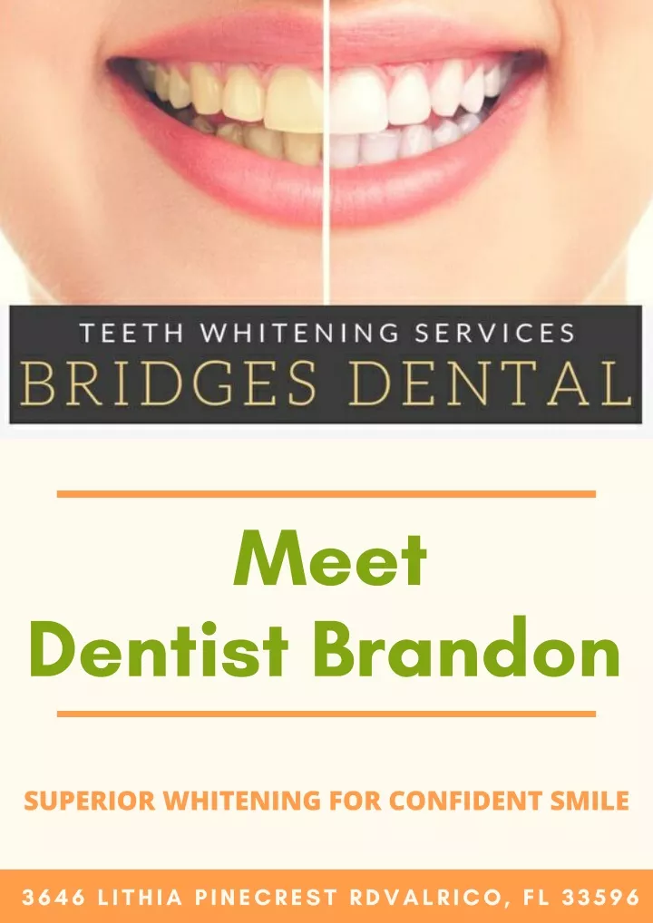 Ppt Dentist Brandon Teeth Whitening For Smile Makeover Powerpoint Presentation Id