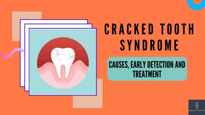 cr a cked tooth syndrome