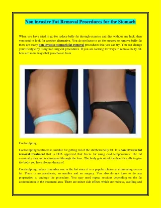 Non invasive Fat Removal Procedures for the Stomach