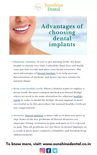 Best Dental Implants in Whitefield | Sunshine Dental