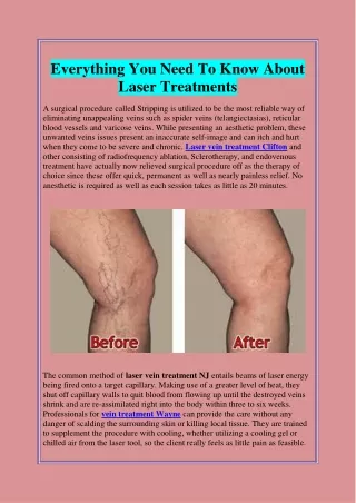 Everything You Need To Know About Laser Treatments