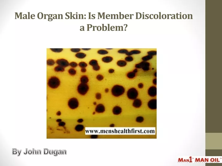 male organ skin is member discoloration a problem