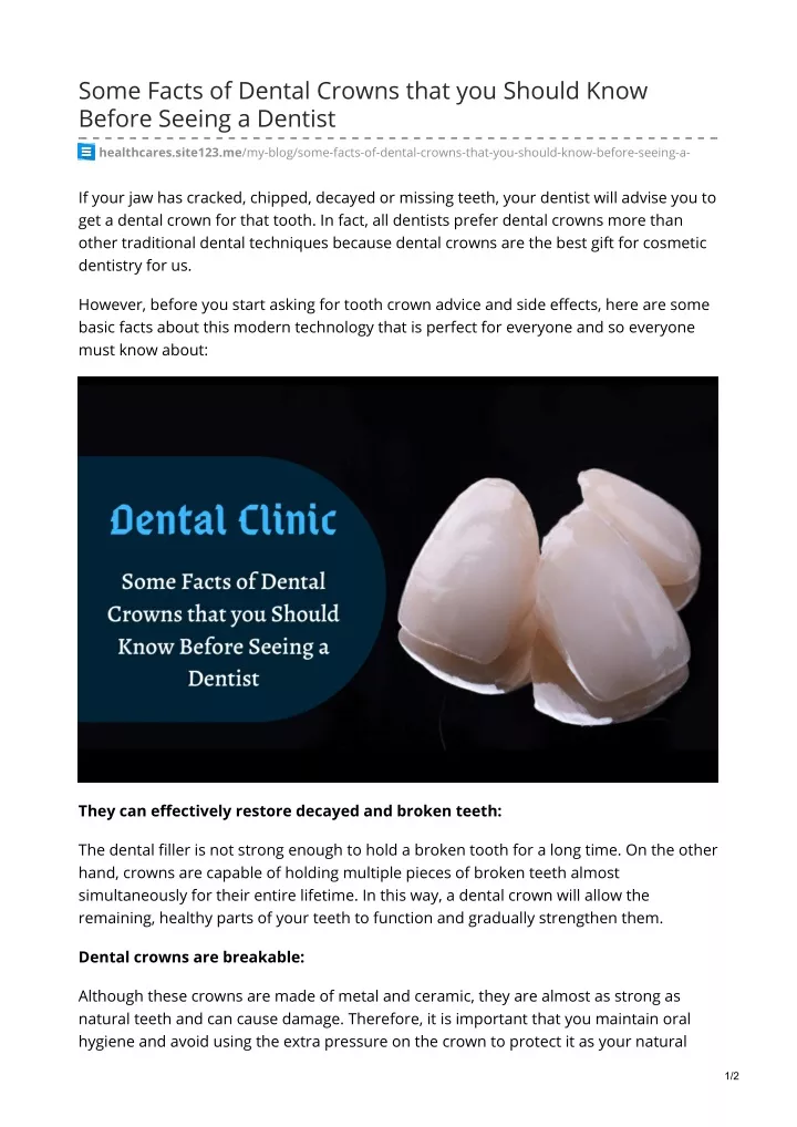 some facts of dental crowns that you should know