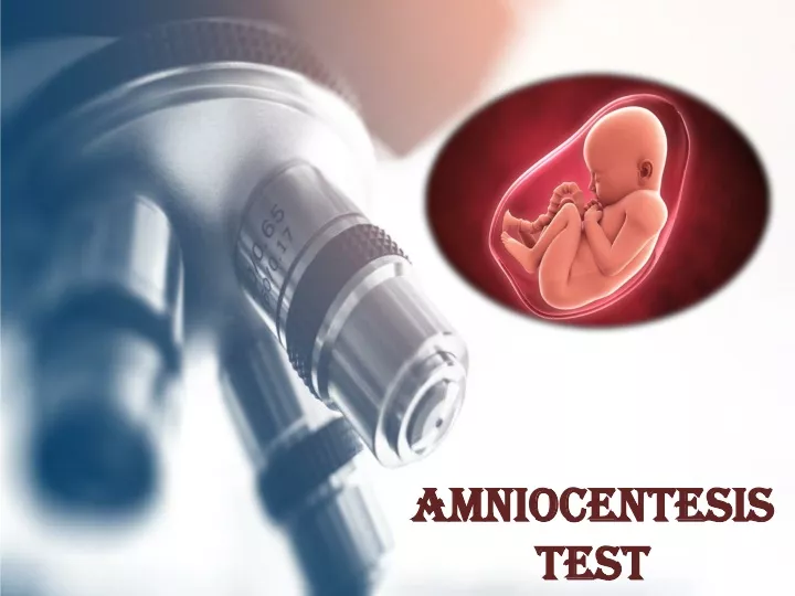 amniocentesis test