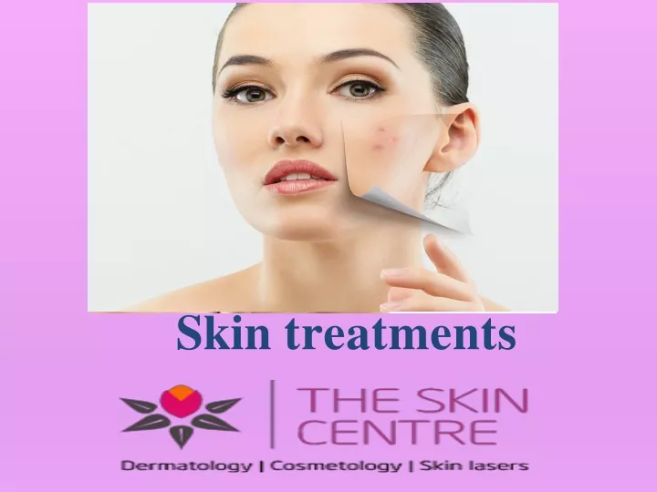 skin treatments