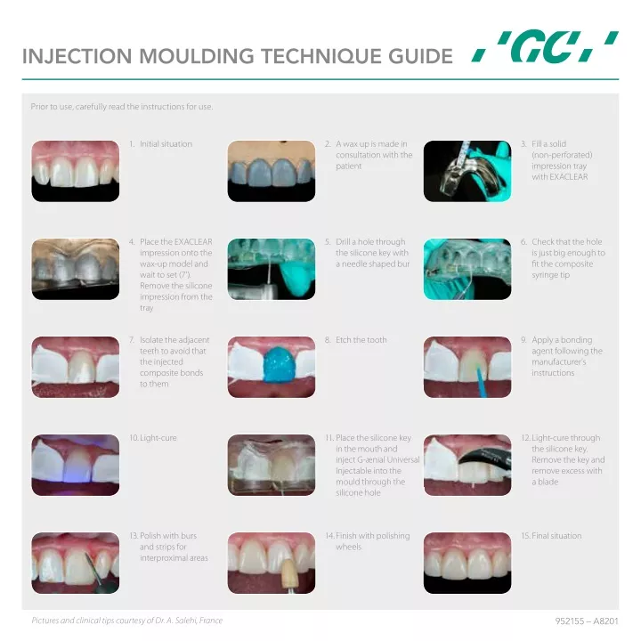 Ppt Gui Manual Injection Moulding Technique Guide For Gc Exaclear Gc India Dental Powerpoint