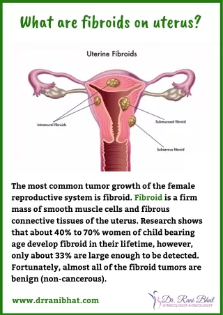 What are fibroids on uterus? | Uterine Fibroids Treatment in Bangalore