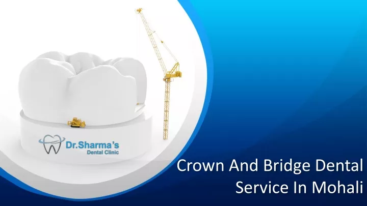 crown and bridge dental service in mohali