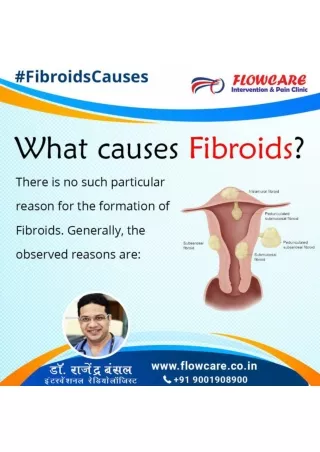 Get fibroid treatment by Intervention radiologist
