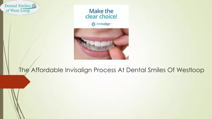 the affordable invisalign process at dental smiles of westloop