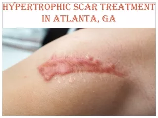 HYPERTROPHIC SCAR TREATMENT IN ATLANTA, GA