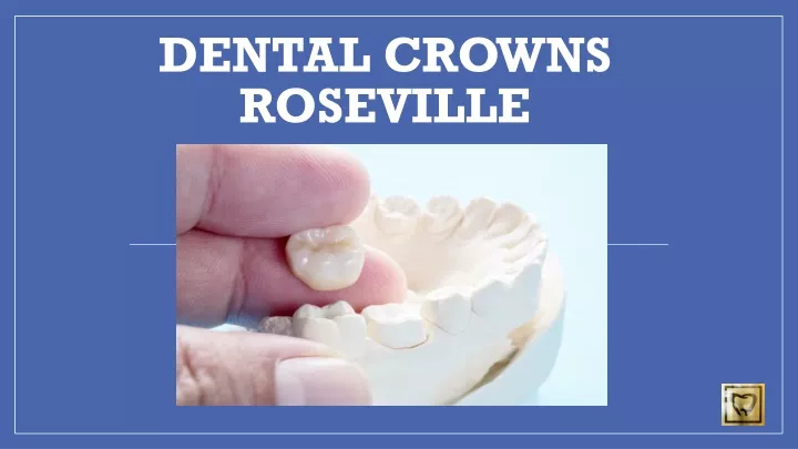 denta l crowns roseville