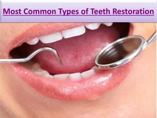 Most Common Types of Teeth Restoration