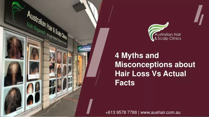 4 myths and misconceptions about hair loss