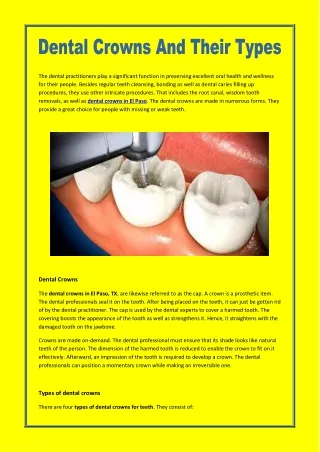 Dental Crowns And Their Types