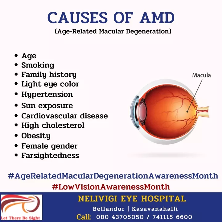 causes of amd age related macular degeneration