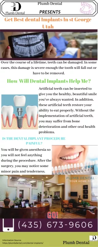 Get Best dental Implants In st. George Utah