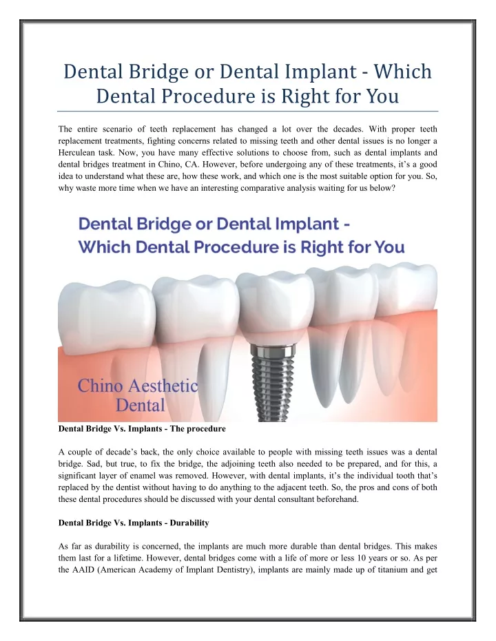 dental bridge or dental implant which dental