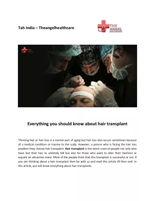 Everything you Should Know About Hair Transplant