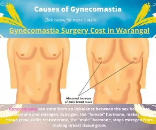 Gynecomastia surgery cost in Warangal