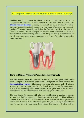 A Complete Overview On Dental Veneers And Its Usage