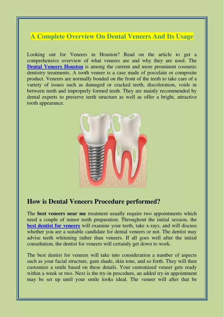 a complete overview on dental veneers