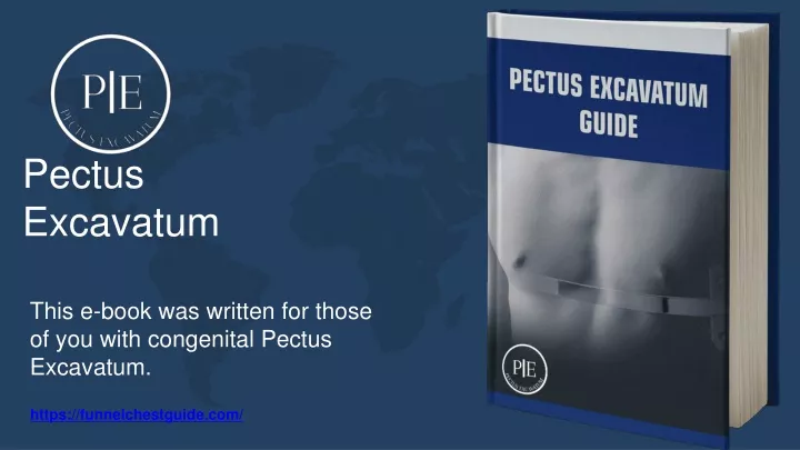 pectus excavatum