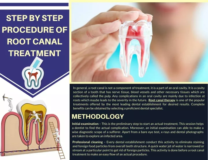 step by step procedure of root canal
