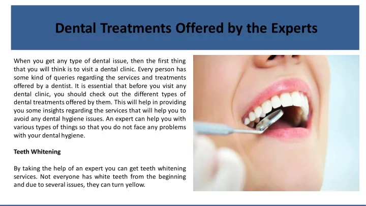 dental treatments offered by the experts