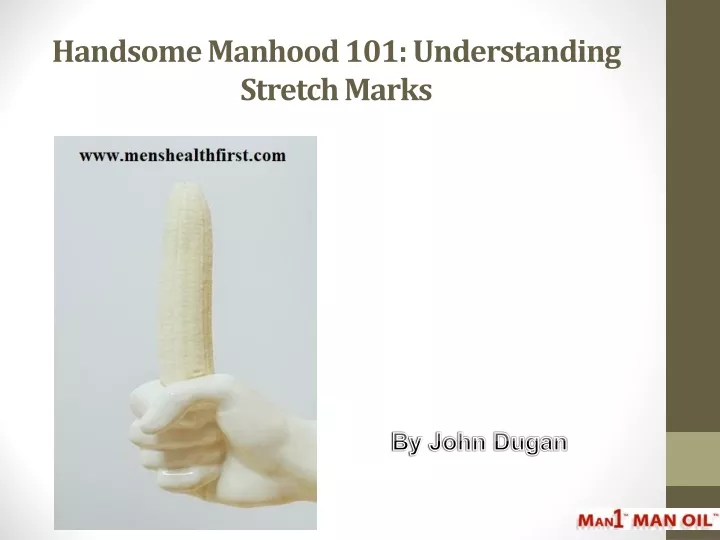handsome manhood 101 understanding stretch marks
