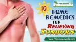 10 Home Remedies for Sunburn Relief - slide 1