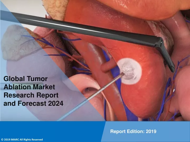 global tumor ablation market research report