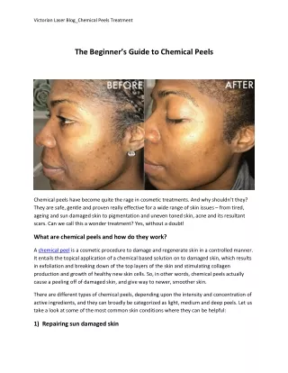 The Beginner’s Guide to Chemical Peels