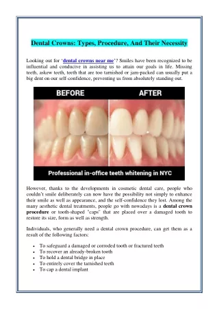 dental crowns types procedure and their necessity