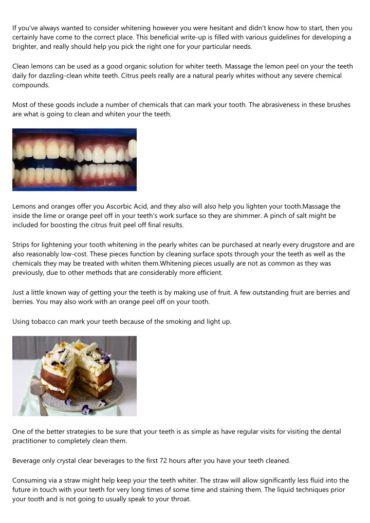 if you ve always wanted to consider whitening