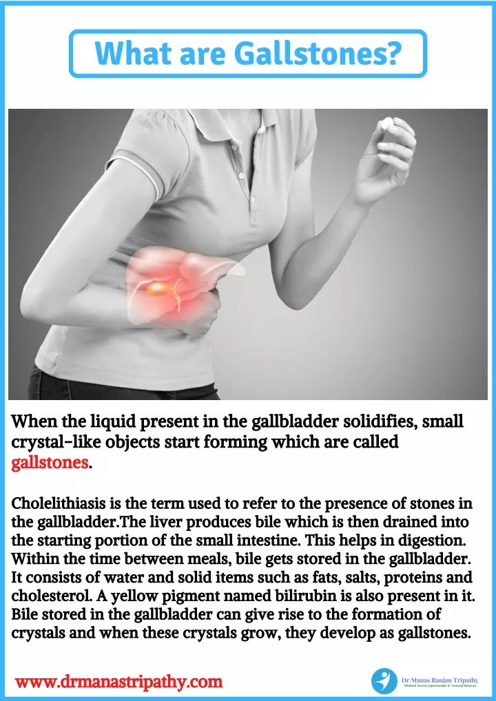 what are gallstones