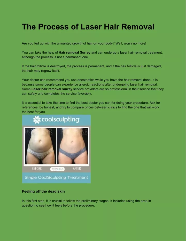 the process of laser hair removal