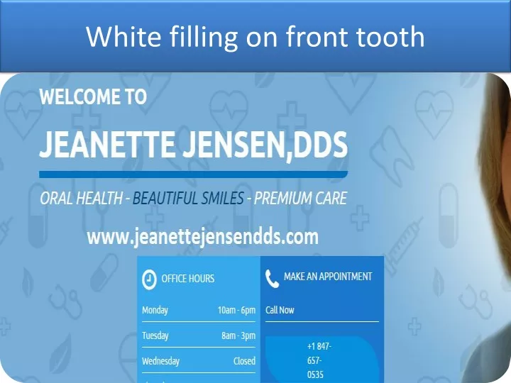 w hite filling on front tooth