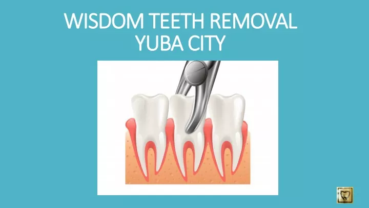 wisdom teeth removal yuba city