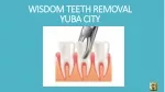 Wisdom Teeth Removal Yuba City - slide 1