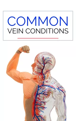 common vein conditions