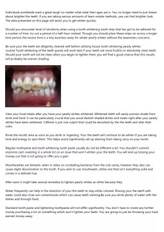 What To Do To Lighten Your Teeth These days!