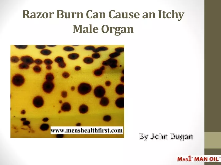 razor burn can cause an itchy male organ