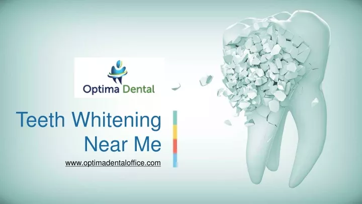 teeth whitening near me